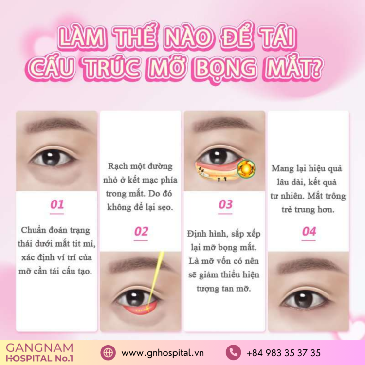 Bí Quyết Phẫu Thuật Đẹp Tại Gangnam Hospital No.1