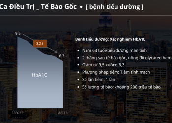 Bước Tiến Trong Điều Trị Tiểu Đường Bằng Tế Bào Gốc | Giải Pháp Tiên Tiến