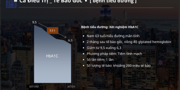 Bước Tiến Trong Điều Trị Tiểu Đường Bằng Tế Bào Gốc | Giải Pháp Tiên Tiến