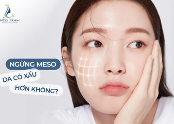 Meso: Giải Pháp Hiệu Quả Giúp Cải Thiện Làn Da và Giữ Vẻ Đẹp Trẻ Trung
