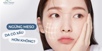 Meso: Giải Pháp Hiệu Quả Giúp Cải Thiện Làn Da và Giữ Vẻ Đẹp Trẻ Trung