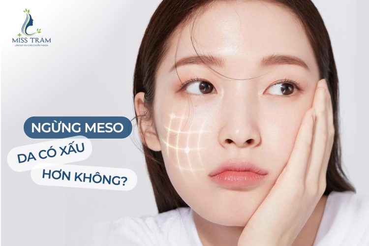 Meso: Giải Pháp Hiệu Quả Giúp Cải Thiện Làn Da và Giữ Vẻ Đẹp Trẻ Trung