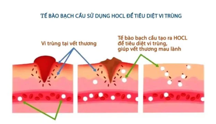 HOCL là gì? Giải Pháp Khử Trùng An Toàn và Hiệu Quả